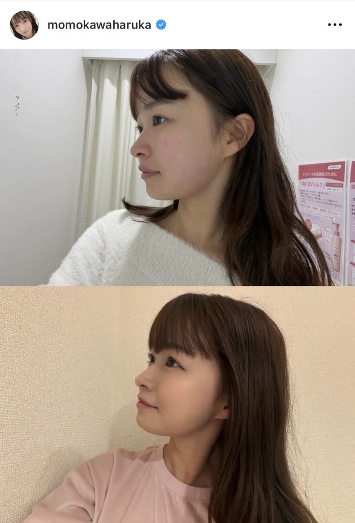 クリニックでの施術ビフォーアフター